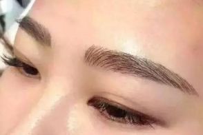 絕佳效果！體驗成都周維開刀雙眼皮的精彩案例