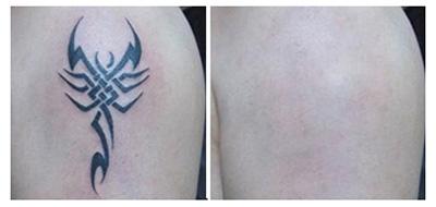 山西省整形外科醫(yī)院劉晉元好不好？割雙眼皮有何特色，值得信賴嗎？