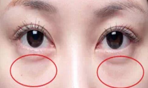 哪位醫(yī)生在八大處能夠為您做出完美的雙眼皮手術(shù)？手術(shù)價格信息附后