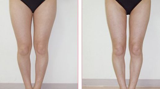 深圳市有哪些經(jīng)驗(yàn)豐富的脂肪填充醫(yī)生？Top五名單揭曉！