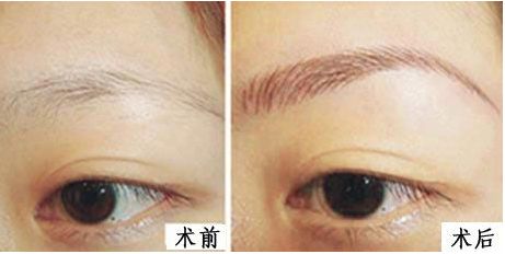 濰坊整形醫(yī)院排行榜揭曉！綜合評比推薦前五強熱門醫(yī)院，超值推薦！