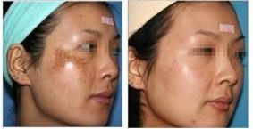 西京醫(yī)院郭樹(shù)忠教授：醫(yī)術(shù)高超，贏得廣泛口碑