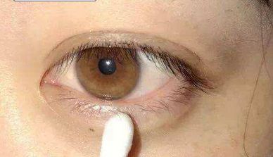 西京醫(yī)院：宋保強醫(yī)生主刀，隆胸手術(shù)安全可靠嗎？