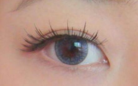 優(yōu)美雙眼輕松可得，了解樓善葉做雙眼皮的詳細(xì)過程和真實案例