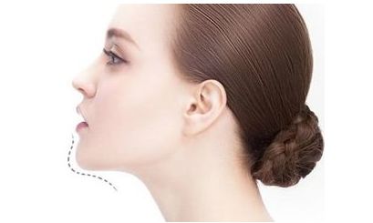 上海九院張?zhí)锰疳t(yī)生2023手術(shù)案例分享，讓你了解周雙白醫(yī)生的臨床經(jīng)驗