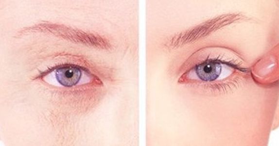 沈陽醫(yī)大二院美容整形科權威專家盛裝亮相，2023價格表曝光，丨真絕佳效果去眼袋案例讓人羨慕