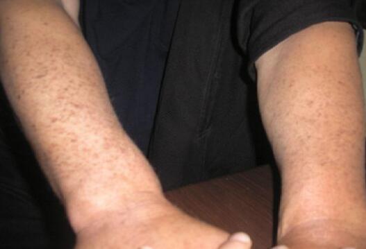 東菀膚康皮膚科醫(yī)院醫(yī)生資歷一覽——這家醫(yī)院的醫(yī)生們經(jīng)驗豐富嗎？是否專業(yè)可靠？