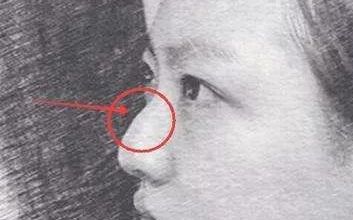 合肥雙眼皮整形醫(yī)院推薦：探尋當(dāng)?shù)?家口碑佳的醫(yī)美機(jī)構(gòu)