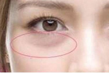 韓國優(yōu)質(zhì)整形醫(yī)院推薦，專業(yè)假體隆鼻術(shù)效果好