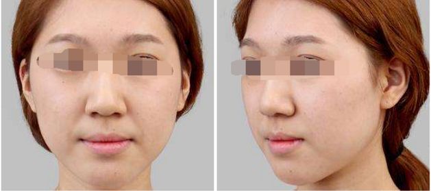 2024年長(zhǎng)沙祛胎記整形醫(yī)院哪家技術(shù)好