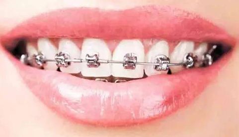 南京美容專家推薦：解決斑點問題的好去處！