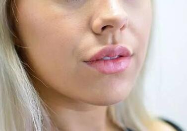 福建省第二人民醫(yī)院整形外科的技術(shù)水平如何？該醫(yī)院整形外科好不好？