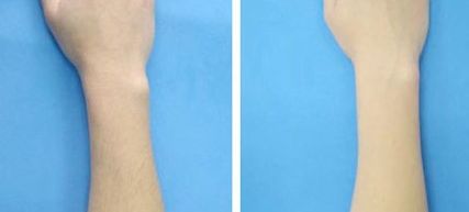 國(guó)內(nèi)哪些醫(yī)生做雙眼皮好？王曉亞、李燕、張穎熱門前五推薦！(2023價(jià)格表附)