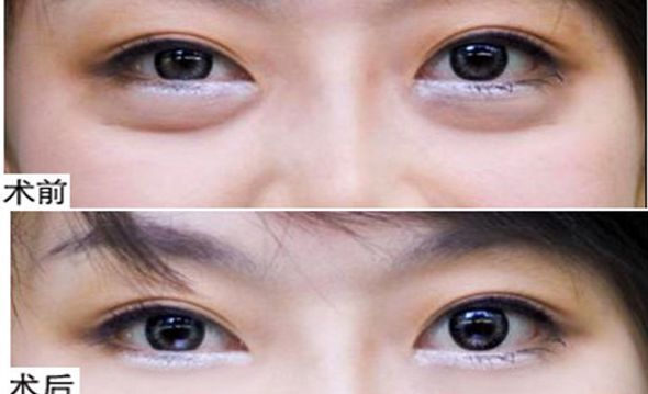 揭曉！鄭州2023年首屈一指的鼻部整形名醫(yī)TOP10震撼排行出爐