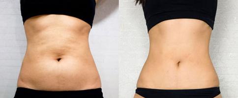 昆明魚美人醫(yī)療整形美容口碑好嗎？專業(yè)醫(yī)院介紹分享