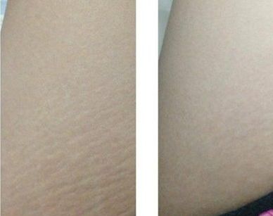 成都哪家醫(yī)院2023熱門(mén)雙眼皮全切推薦，醫(yī)院名單及簡(jiǎn)介全解析！