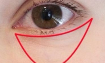 長沙優(yōu)秀的雙眼皮修復(fù)醫(yī)生，找到周芳醫(yī)生和李超醫(yī)生