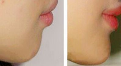 鄭州鼻部整形名醫(yī)盤點！權(quán)威醫(yī)生七人班底完美曝光