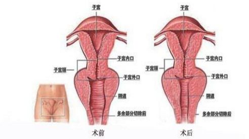 北京最佳乳房再造醫(yī)院排行榜，八強(qiáng)環(huán)境多元，知名醫(yī)生鼎力支持