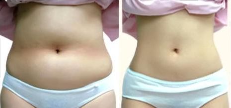 昆明市熱門植發(fā)醫(yī)院排行榜，公立私立都在內(nèi)，你值得擁有更好的選擇