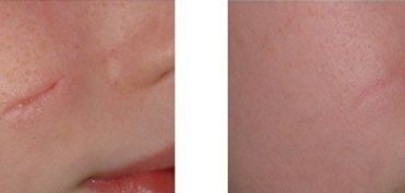 昆明知名醫(yī)生解讀三角眼與下垂眼手術(shù) 手術(shù)專業(yè)有哪些？