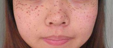 深度解析廣東萊美醫(yī)療美容醫(yī)院吸脂技術(shù)優(yōu)劣，費(fèi)用詳細(xì)解讀