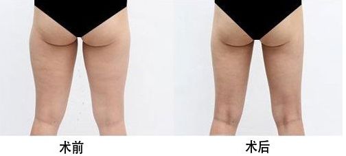 西安雙眼皮修復(fù)醫(yī)生榜單揭曉！頂級專家實力合集！