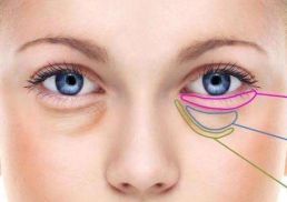 眼部整形北京，哪家醫(yī)院實力最強？三所醫(yī)院大比拼