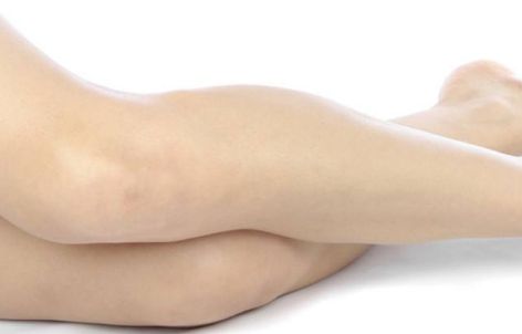 武漢華美李小丹醫(yī)生吸脂術(shù)的效果如何？案例公布供參考