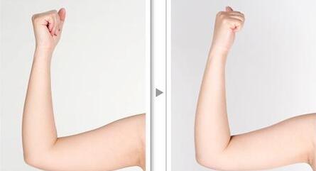 贛州市人民醫(yī)院美容整形科值得信賴嗎？2023價格表分享