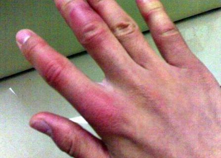 南京市哪家醫(yī)院能有效治療色斑問題呢？