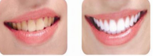 南昌哪家整形醫(yī)院的除皺手術(shù)比較好？前十實(shí)力醫(yī)院推薦!