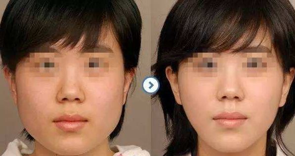 邯鄲梵星醫(yī)療美容：技術(shù)實力聚焦，項目擅長解讀，價格參考公開