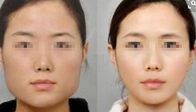 2024年鄭州市熱門整形醫(yī)院推薦，在排名前10中有哪些？