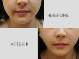 深圳整形醫(yī)院排行前三極具口碑，美麗同仁、藝星醫(yī)療、華美醫(yī)療引領(lǐng)潮流