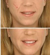 長沙東宸醫(yī)療整容醫(yī)生推薦技術(shù)成果展現(xiàn)，費用參考來啦！