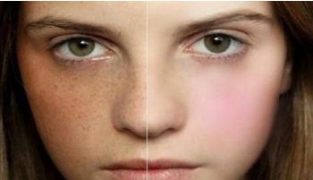 上海腹壁整形術(shù)受歡迎的醫(yī)院排行榜，九院、華美和伊萊美等備受推薦