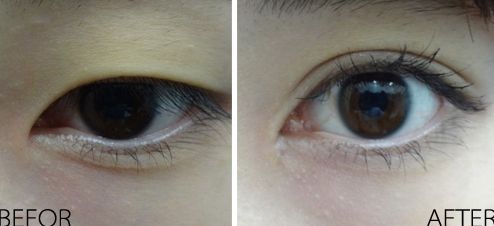 長(zhǎng)沙的吉大二院整形科效果如何？項(xiàng)目費(fèi)用一覽表2023