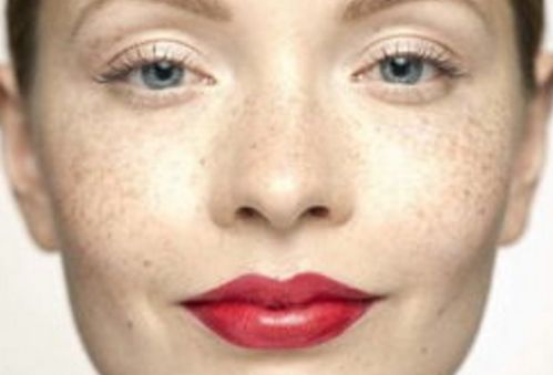 孫澤芳醫(yī)生的眼袋手術(shù)效果如何？醫(yī)生背景資料與實際手術(shù)對比圖分享