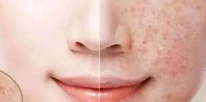 2023年大連顴骨顴弓修復(fù)醫(yī)生推薦，醫(yī)師排行公開(kāi)！附最新收費(fèi)一覽！