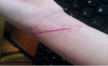 哈爾濱市第五醫(yī)院整容科負(fù)責(zé)人是誰(shuí)？名醫(yī)陣容+服務(wù)價(jià)目公示給您參考