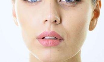 2023醫(yī)生推薦的鼻綜合重塑，讓邱文苑的鼻子煥然一新！