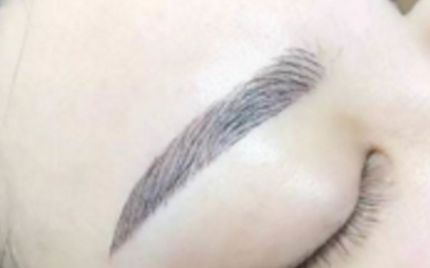 深圳拉皮手術(shù)醫(yī)生五強揭曉！千人口碑薦：排行榜、專家推薦