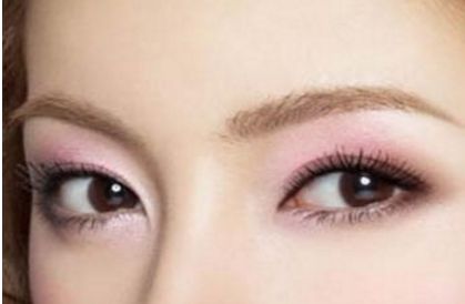 北京協(xié)和醫(yī)院白明醫(yī)生的雙眼皮手術(shù)效果如何？真實案例展示給你看