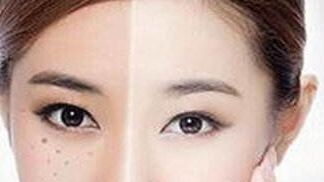 獨(dú)家揭秘！了解重慶楊武林醫(yī)生的墊下巴整形全過(guò)程