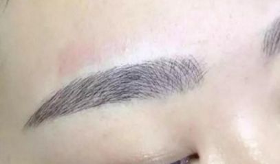 長沙何瑋醫(yī)生匠心獨具，驚艷的雙眼皮效果案例匯總