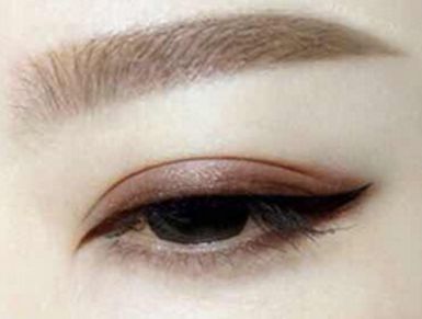 盧尚兵醫(yī)生成功挖掘雙眼皮修復秘密，踏實解決眼皮腫脹問題