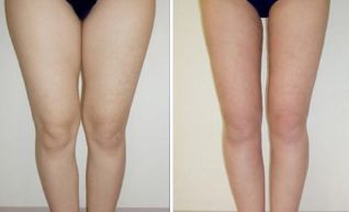 北京八大處：祛除眼袋夜明星醫(yī)生揭曉！