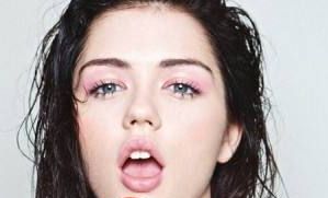 朱亞麗醫(yī)生實例分享：專業(yè)激光祛斑效果如何？