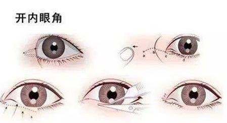 北京哪家專業(yè)醫(yī)院提供高水平的拉皮手術(shù)服務(wù)？權(quán)威機(jī)構(gòu)，口碑一流，高性價比可靠選擇！